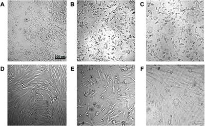 Bacterial-mediated synthesis and characterization of copper oxide nanoparticles with antibacterial, antioxidant, and anticancer potentials